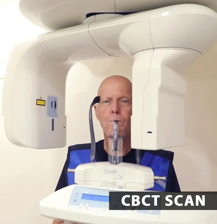 Full-Skull 3D Cone Beam CT (CBCT) Scan
